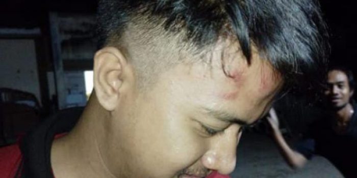 Dihajar Sejumlah Polisi, Jidat Mahasiswa UNIPO Ini Memar